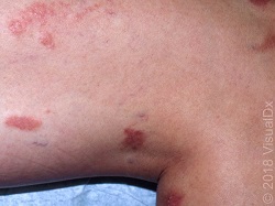 Dermatology Times